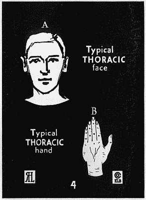 Benedict 1921: typical face and hand for the Thoracic type