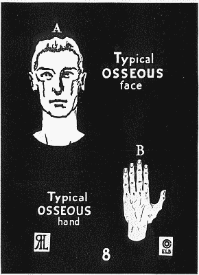 Benedict 1921: typical face and hand for the Osseous type